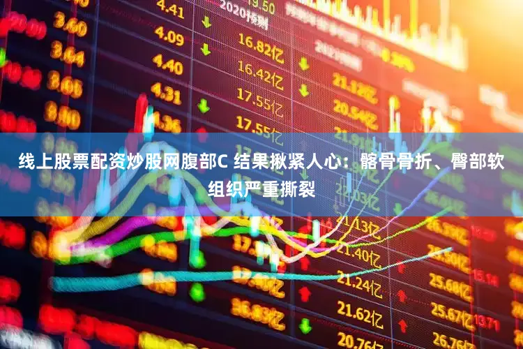 线上股票配资炒股网腹部C 结果揪紧人心：髂骨骨折、臀部软组织严重撕裂